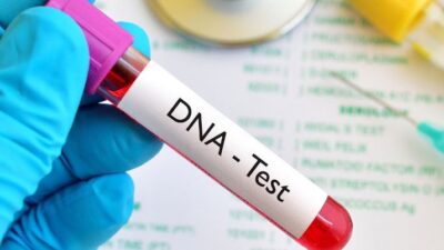 DNA test price in Nigeria